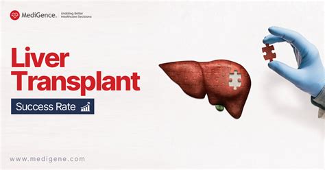 Qual é a taxa de sucesso do transplante de fígado