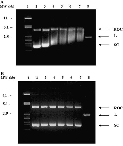 Native gel electrophoresis of supercoiled plasmid DNA in the absence... | Download Scientific ...