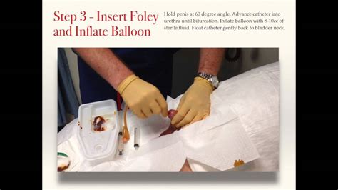 How do nurses perform a Foley catheter insertion?