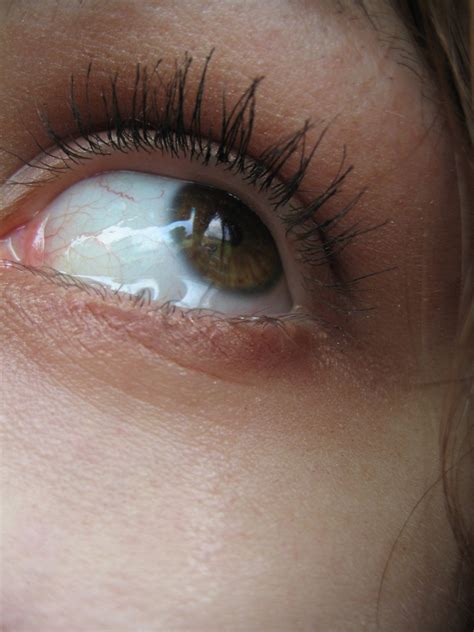 Best Cure For Eye Problems: Causes and Cure of Watery Eyes