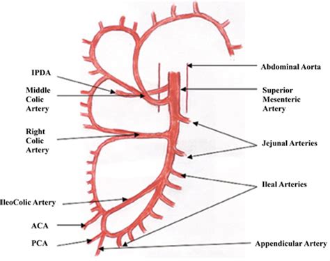 Acute Mesenteric Ischemia: A Challenging Diagnostic Disease—Four Cases Reports and Literature ...