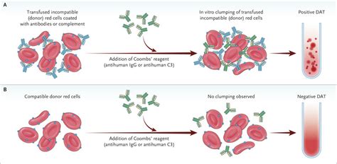 Hemolytic Transfusion Reactions | NEJM