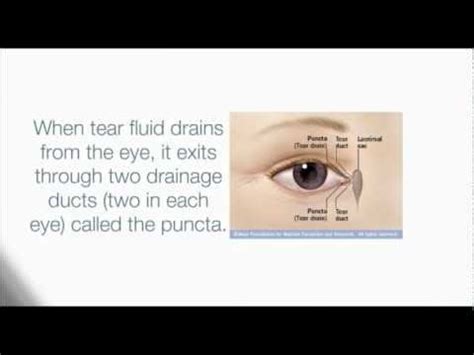 What are punctal plugs? | Eye care, Health education, Eye health