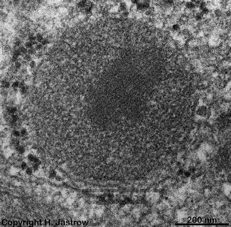 Peroxisomes Dr.Jastrow's EM-Atlas