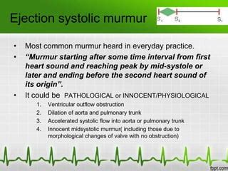 Systolic murmurs | PPT