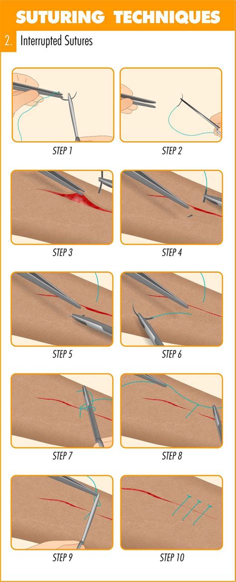 Surgical Suturing Techniques Mastery Guide - Apprentice Doctor