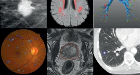 Biomedical Imaging – Analytics Vidhya – Medium