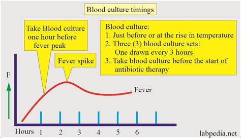 Blood Culture, its Procedure and Interpretations - Labpedia.net