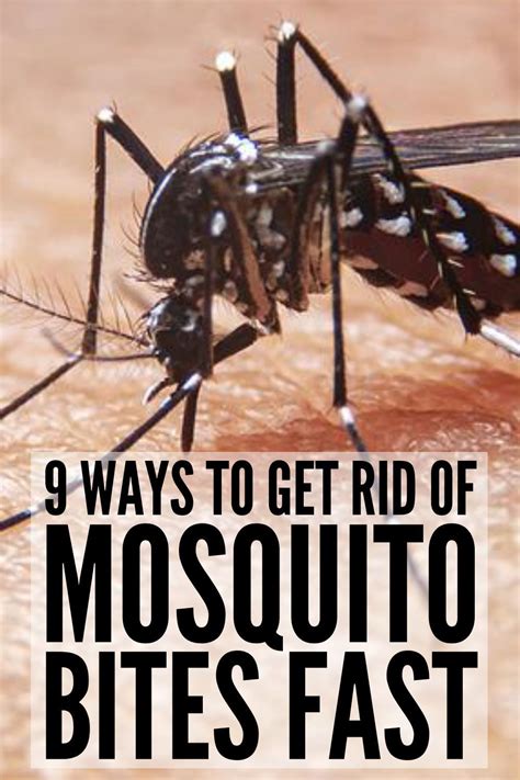 Natural Mosquito Bite Remedy, Mosquito Bite Itch Relief, Itchy Mosquito Bites, Itchy Bug Bites ...