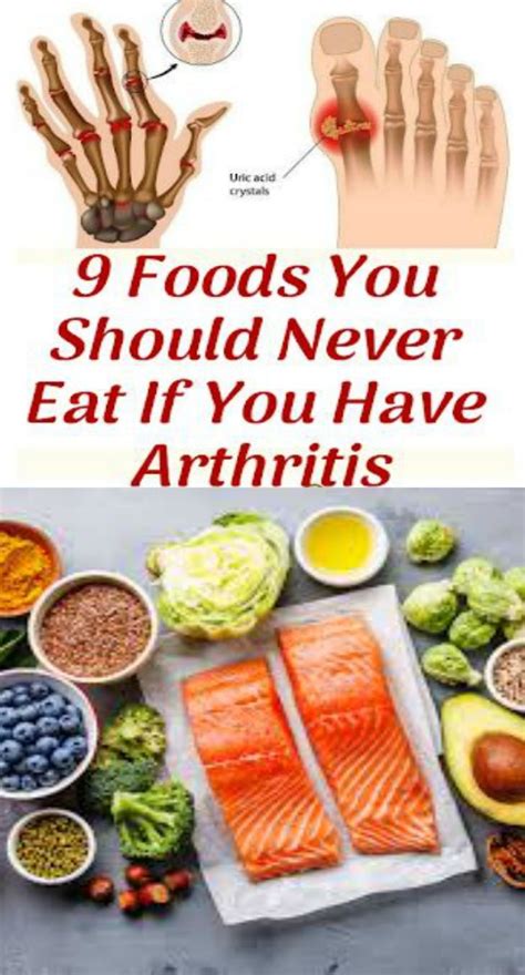 9 Foods You Should Never Eat If You Have Arthritis | Food, Healthy recipes, Healthy