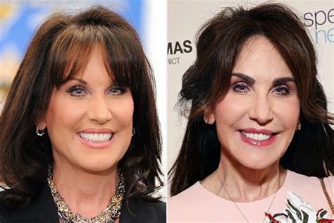 Robin McGraw, Wife Of Dr.Phil Talked About The Plastic Surgery Rumors; She Had A Eyebrow ...