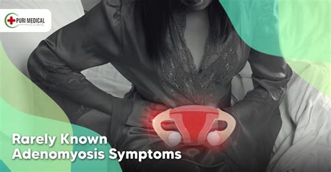 Rarely Known Adenomyosis Symptoms - Puri Medical - Dentist Bali