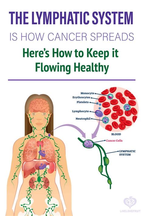 The Lymphatic System Is How Cancer Spreads - Here Are 10 Ways To Keep ...