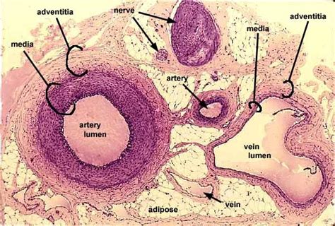 USMLE Pathology Slides - Artery, cross section Consists of a thick ...