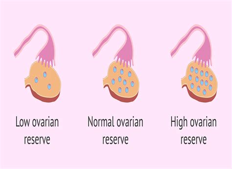 What is Antral Follicle Count (AFC)? : Dr. Mona Dahiya