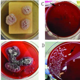 Cultures from lung biopsy and cervical lymph node homogenate. (A) Lung... | Download Scientific ...