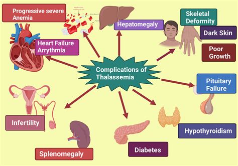 Cureus | Thalassemia: A Review of the Challenges to the Families and Caregivers