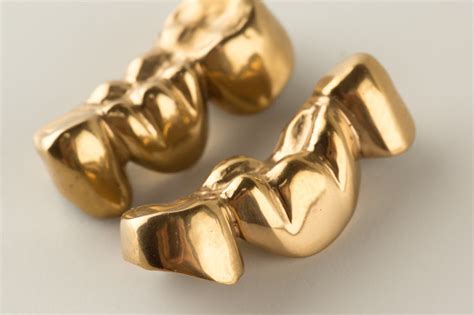 Dental Crowns by Brisbane City Dentist