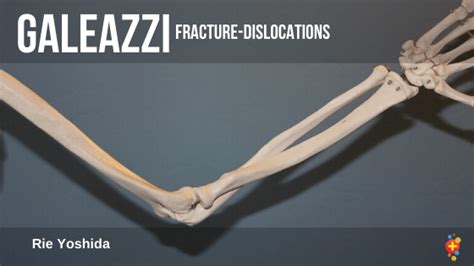 Galeazzi fracture-dislocations - Don't Forget the Bubbles