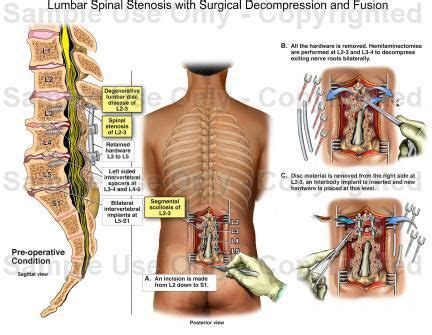 L5 S1 Anatomy - Anatomical Charts & Posters