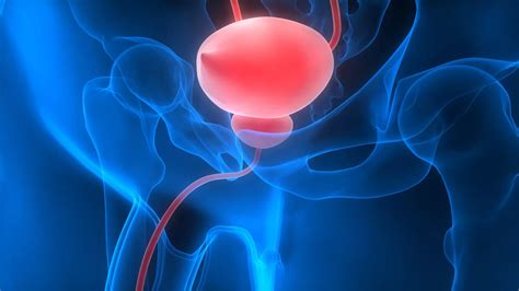 All About Bladder Cancer: Symptoms and Treatment - Assure Urology & Robotic Centre