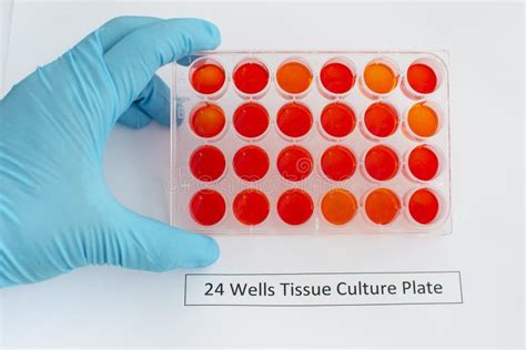 Tissue culture plate stock image. Image of research, laboratory - 64238811