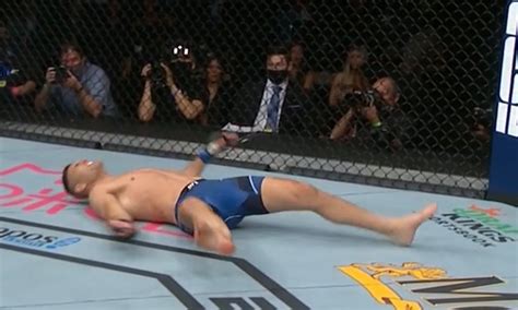 Chris Weidman still worried his leg might have to be amputated due to ...