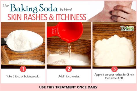 10 Benefits of Baking Soda for Hair, Skin and Body - Page 3 of 3 | Top 10 Home Remedies