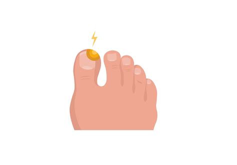Sudden Thickening Of Toenails Causes - My Bios