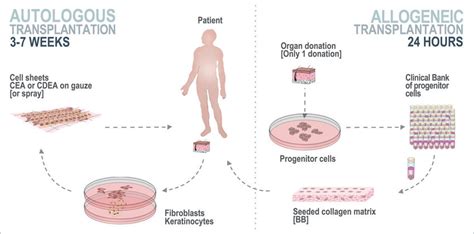 Autologous and allogeneic cell therapy performed at the CHUV Burn ...