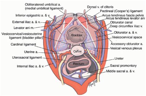 Sacrocolpopexy | Obgyn Key