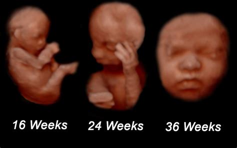 When is the Best Time to Get a 3D Ultrasound? - Mother Nurture Ultrasound