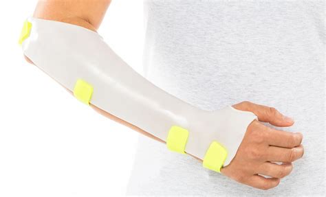 The Muenster Orthosis and Sugar Tong Orthosis - Orfit Industries