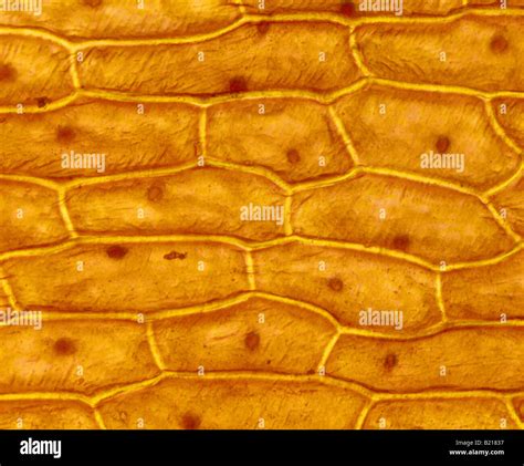ONION SKIN CELLS EPIDERMAL CELLS SHOWS CELL STRUCTURE AND NUCLEUS STAINED IN IODINE LIVE 100X ...