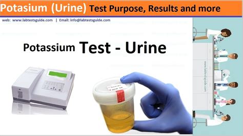 Potassium (Urine) Test Causes, Purpose, Overview and more - Lab Tests Guide