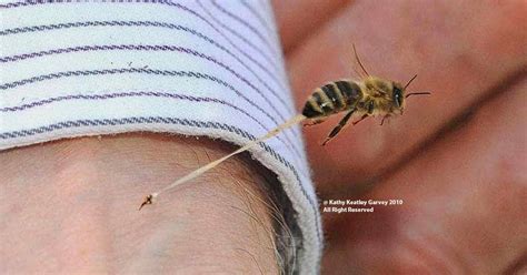 Anatomy Of A Bee Sting | Ben's Bees