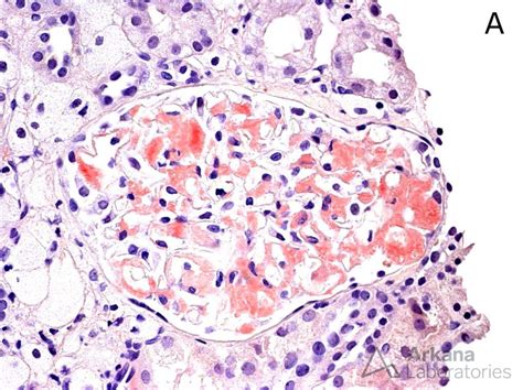 Congo Red Stain Tutorial | Teaching Points | Arkana Laboratories