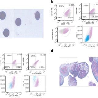 Morphology and immunophenotype features of U266 cell. Lymphoblastic (a)... | Download Scientific ...