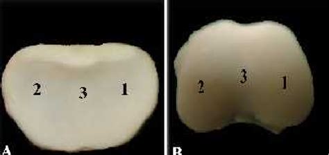 photograph of the articular surfaces of the pastern joint of the... | Download Scientific Diagram