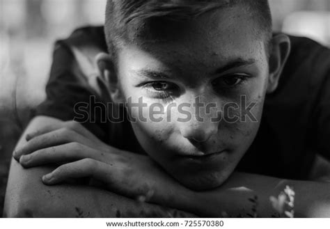 Portrait Young Boy Pimples On Face Stock Photo 725570380 | Shutterstock