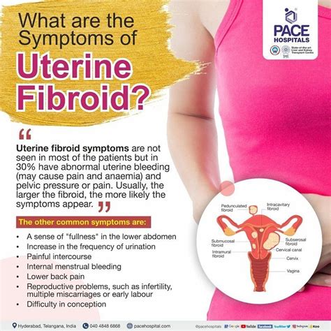 Uterine Fibroids - Symptoms, Causes, Complications and Prevention