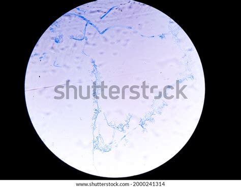 Fusarium Oxysporium Stock Photos - 3 Images | Shutterstock