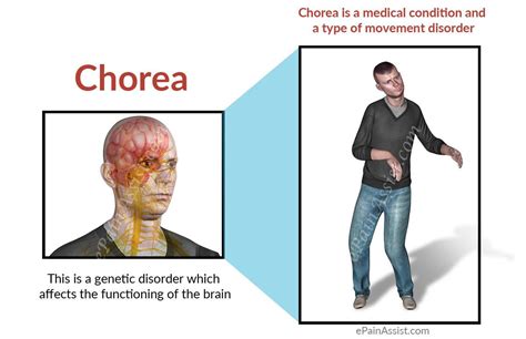 Symptoms of Chorea include... - Niramaya - The Mind Centre | Facebook