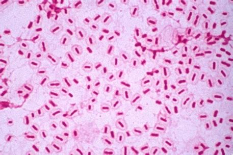 Haemophilus influenzae: Characteristics, Habitat , Pathogenicity ...