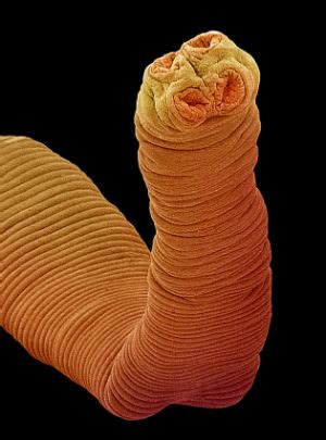 TERMINAL TAPEWORM: Colombian man found to have tapeworm that ...