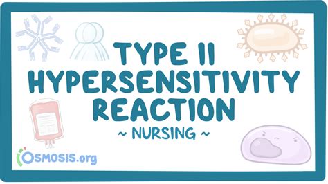 Hypersensitivity reactions - Type II: Nursing: Video & Causes | Osmosis