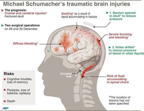 Beiruting - Life Style Blog - Michael Schumacher still comatose in French hospital