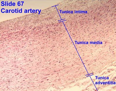 Aorta Microscope Image Labeled