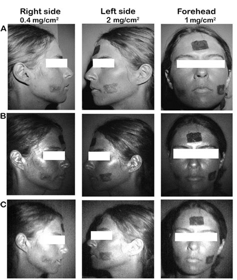 Comparison of UV photography devices. (A) A digital single-lens reflex... | Download Scientific ...