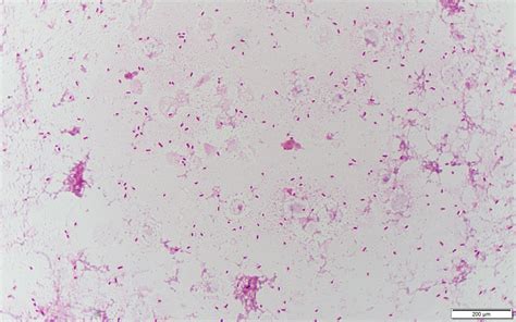 Aeromonas hydrophila〔エロモナス〕 | グラム染色: Gram Stain